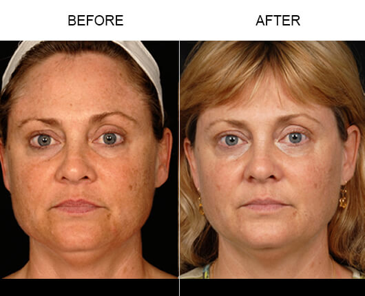 DOT Therapy Results DOT Therapy Results