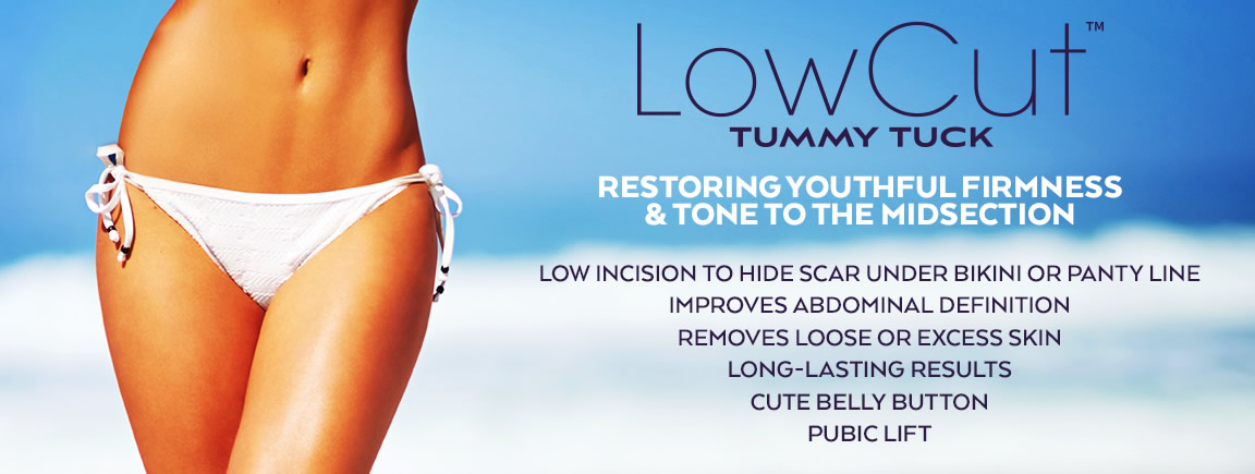 LowCut Tummy Tuck Procedure LowCut Tummy Tuck Procedure